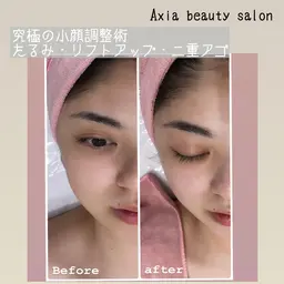 究極の小顔調整術【立体小顔】❣️顔の歪みを整えて立体感のあるバランスのとれたお顔をつくります