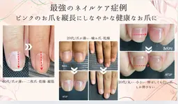 自爪育成　最強のネイルケアコース