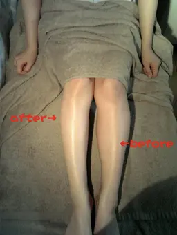 <B>［部分ヤセ★下半身太り/むくみなど］独自技術の効果に驚く！キャビテーション＆スーパーセルム分解&燃やす体験135分