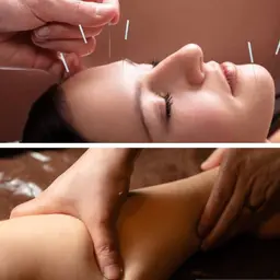 【OPEN記念⭐️人気No.2】美容鍼×全身リンパマッサージ90分