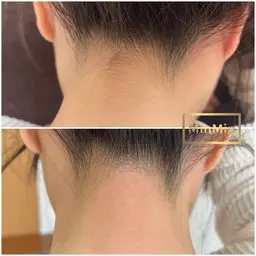 【ミニモ限定】 部分フェイスワックス|鼻下・もみあげ・えりあし