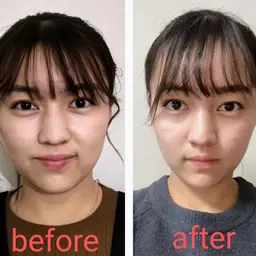 【顔ヤセ・スッキリ−3kg見え☆】小顔矯正+リフトアップ