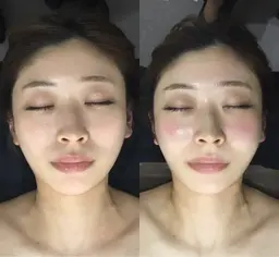 緊急🚨当日限定ミニモクーポン✨小顔リフトアップ矯正+上半身ほぐし付🉐韓国アイドル小顔コルギ🇰🇷枠数わずか!⚠️