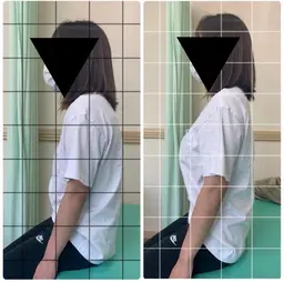 【猫背矯正😺】リピーター続出‼️姿勢分析＋猫背矯正✨巻き肩改善🌟姿勢改善で見た目スッキリ🤗