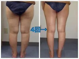 【痩身】ブライダルエステ👰♀️マシンかけ放題+リンパマッサージ+ヘッドスパ+超音波小顔コルキ+温活¥19800