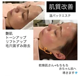 温パックエステ（Waxエステ）