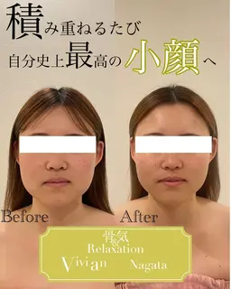 小顔コルギ➕頭蓋骨調整