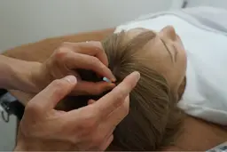 育毛プログラム初回お試しコース