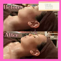 【クリスティーナ🧡フォーエバーヤング】❣️コルギ級の小顔・毛穴引き締め・リフトアップ✨通常¥24,200