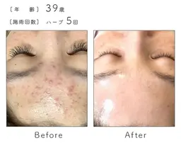 【相談】メニューにお悩みの方！肌カウンセリング🥚⭐️