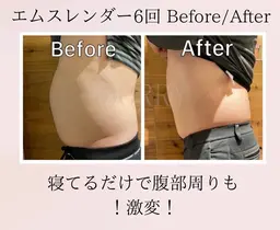 ｢楽して痩せたい｣#寝るだけダイエット#代謝爆上がり🩵Mスレンダー30分