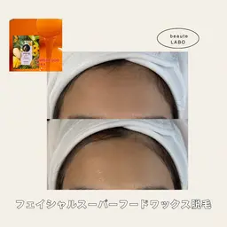 フェイシャルスーパーフードワックス脱毛【waxxxx使用】