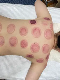 もみほぐし40分➕リンパマッサージ30分➕カッピング30分