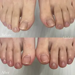 【フット】こだわりケア