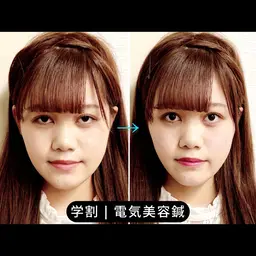 【卒業・新生活に◎】ミニモ学割U24 小顔美容鍼×EMS 30分