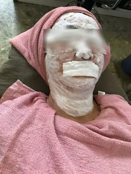 毛穴汚れ、ザラつき、テカリにおすすめ！毛穴ケア(ヘッドトリートメントまたはハンドケア付き)