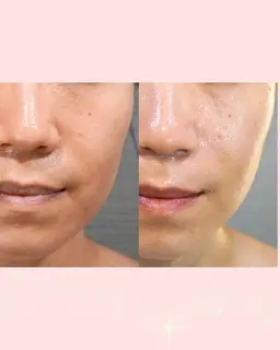 【お悩み：むくみ】小顔スッキリ♪リフトアップフェイシャル　60分（初回カウンセリング・着替え込み120分）