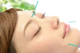 お悩み箇所集中美容鍼❣️ 60分😄✨ 60分個室で安心☆