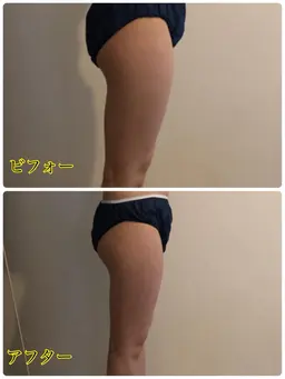 上半身or下半身　筋膜リリース