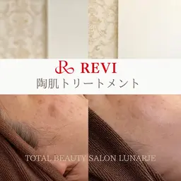 【平日限定☆】剥けないハーブピーリング　追加オプション2個無料！