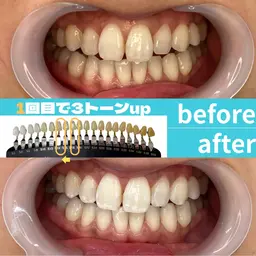 【定額制/通い放題パックをご希望の方】¥5,500​〜​