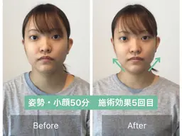 ｟🌸期間限定🌸口コミ投稿募集｠顔の歪み＋小顔整体・姿勢調整【50分15900→0円】