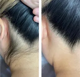 【女性】前撮り・式典にも🤎🕊うなじワックス✨光脱毛追加＋¥2,000  メッセージでお知らせください