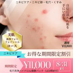 🎊新メニュー🎊🌟美肌光フェイシャル🌟【ニキビケア】【毛穴ケア】ハイドロスプラッシュ×LED照射付き★