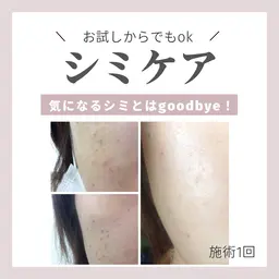 シミケアトライアル💆‍♀️♡まずはお試しから💓