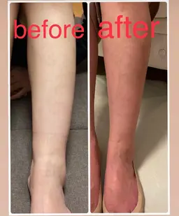 フットリンパマッサージ