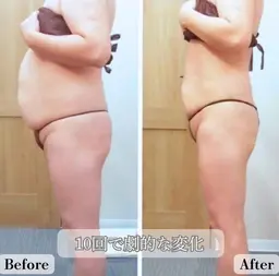 【全身痩身ダイエット♪】4Dシェイプ+ハイパーナイフ+全身リンパ《90分》