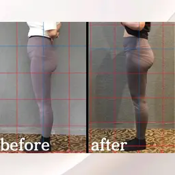 【リピーター様】産後骨盤矯正