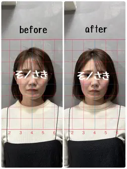 ⭐️リフトアップ⭐️小顔矯正⭐️60分🔥人気No2メニュー🔥初回のみ口コミ割、特典付き✨ 初回ご来店の方のみ可