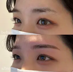 ハリウッドブロウリフト