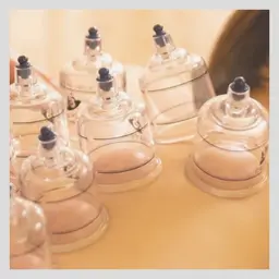 【ミニモ限定メニュー】カッピング(吸玉)首肩こり 背中のはり むくみ解消 ダイエット効果