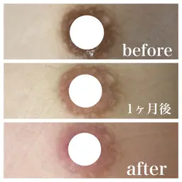 韓国でも大人気ローマピンク🩷