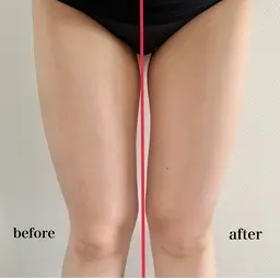 【目に見て分かる痩身効果！】エアインジェクター導入（2箇所）+マッサージ（1部位）