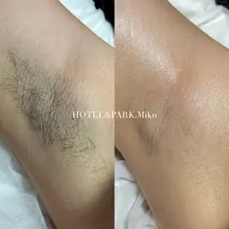 1月限定❄️⛄️【VIO+両脇ワックス脱毛】