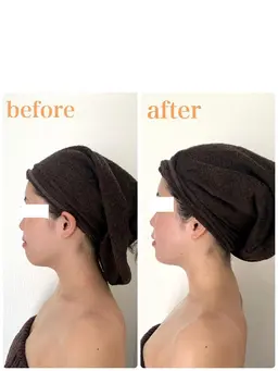 一度で小顔効果！！たるみ、エラ張り、歪み、むくみに！小顔フェイシャルマッサージ60分【デコルテ・頭皮マッサージ付き】