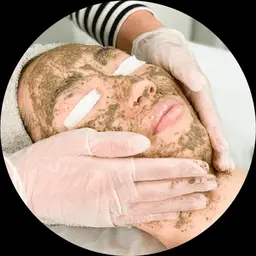 リアボーテ ハーブピーリング🌿プラチナピコスピアに6種のヒト幹細胞培養液を封じ込めて真皮層にダイレクト導入！