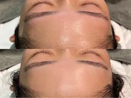 フルフェイスWAX顔脱毛×贅沢パック✨