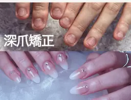 【自爪育成／深爪矯正コース】長さだし+ジェルコース🌟専門の知識と技術で、自爪を造形し、見違える指先に🌟💅