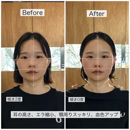 整顔スパ(シャンプーブロー込み)