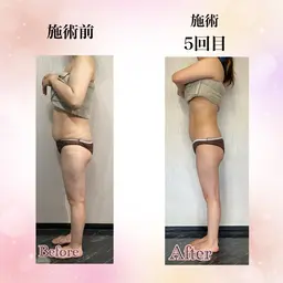 全身アロママッサージ