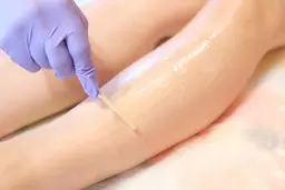 全身ワックス脱毛