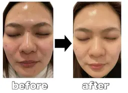 【毛穴ホワイトスノーピール】即効で毛穴レス肌に、美白も叶う!¥9500→¥7500