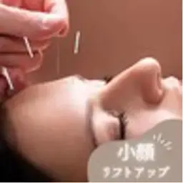 【人気NO.2】美容鍼(電気＋幹細胞パック)＋ヘッドスパ 11000 → 7700