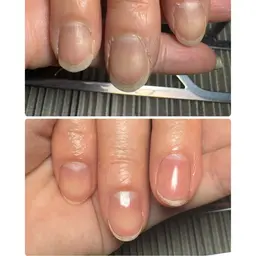 ネイルケア
