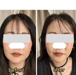 不調なところを全身調整!骨盤矯正✖️整形級小顔ヘッドスパ!肩こり頭痛も解消!