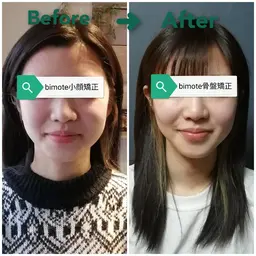 新規女性限定🍀美顔も美脚も美姿勢も✨ シワ⭕美白効果⭕リフトアップ⭕バストアップ⭕腸もみ⭕ 小顔＋全身矯正 120分